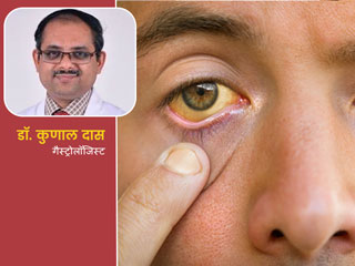 क्या पीलिया में दूध पी सकते हैं या पीलिया कितने पॉइंट होना चाहिए? जानें इस रोग से जुड़े ऐसे 8 सवालों के जवाब
