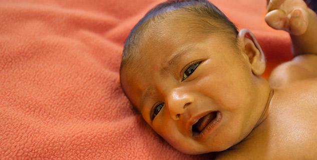 jaundice_in_new_borns