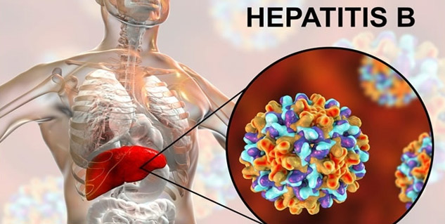 Hepatitis_B