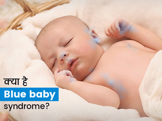 Blue baby syndrome: इस बीमारी में नीला पड़ जाता है बच्चों का शरीर, जानें कारण, लक्षण और बचाव के उपाय
