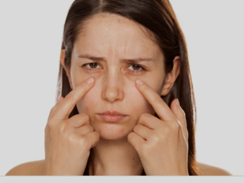 Ayurveda Recommended Natural Treatments To Cure Deep Sunken Eyes