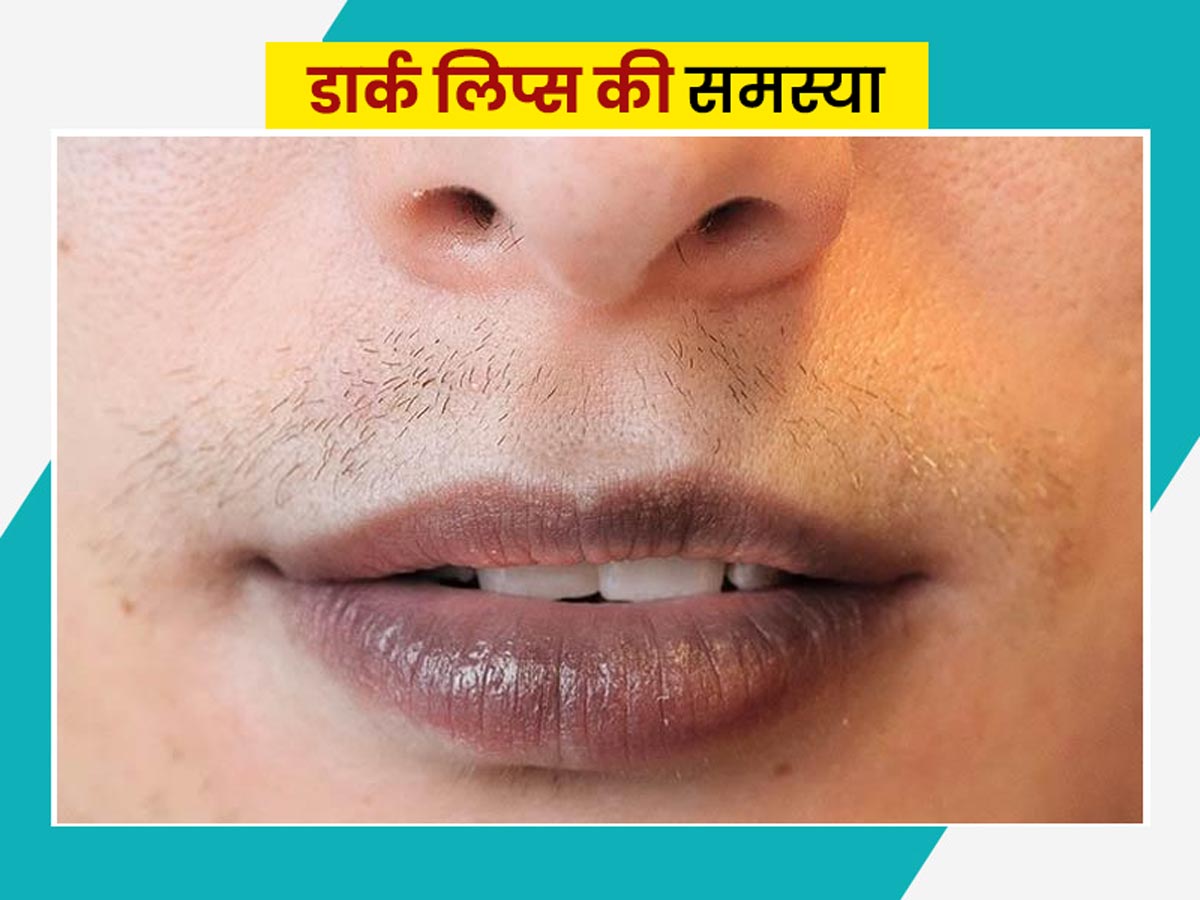 How To Remove Black Colour Of Lips In Hindi