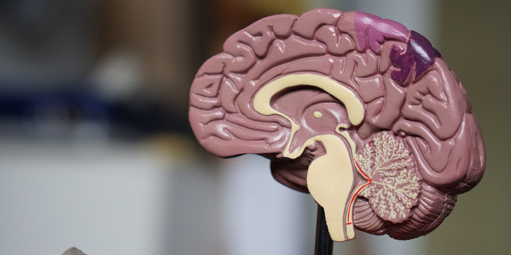 What Is CreutzfeldtJakob Disease Know More About This Rare Disease