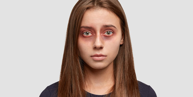 UV-Light-Effects-on-Eyes