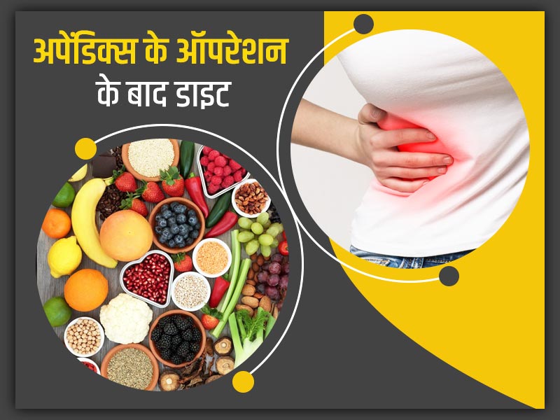 अपेंडिक्स का ऑपरेशन होने के बाद क्या खाना चाहिए और क्या नहीं? एक्सपर्ट से जानें