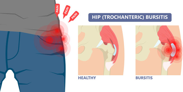 These 5 Health Conditions Can Lead To Stabbing Pain In Left Groin In Females