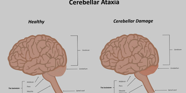 Clinical Skills: Neurological Examination | Exams Clinical Medicine |  Docsity