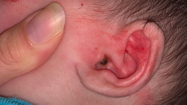 red ear
