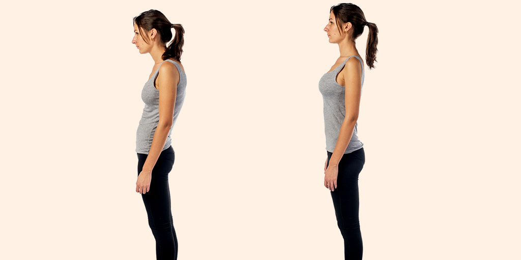 Lordotic Posture: Types, Causes & Exercises For Posture Correction - Lordotic Posture: Types, Causes & Exercises For Posture Correction