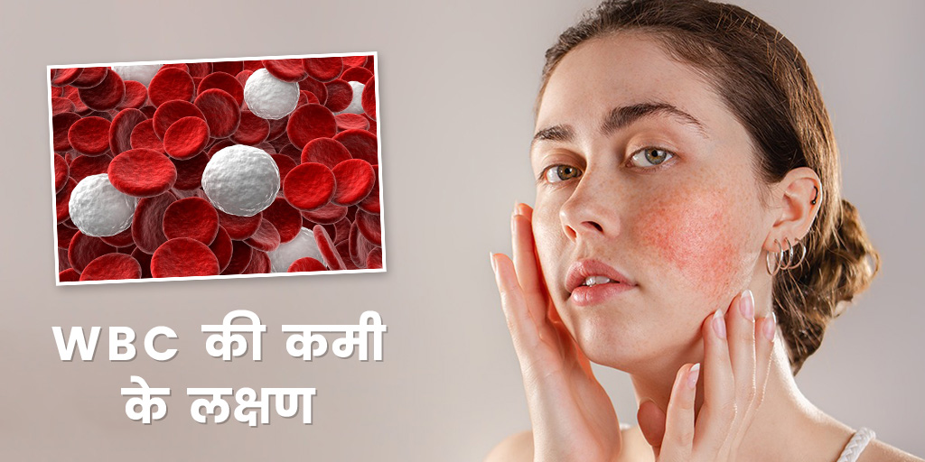 Symptoms Of Low White Blood Cells In Hindi व्हाइट ब्लड सेल्स Wbc की
