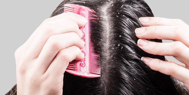Dandruff Treatment