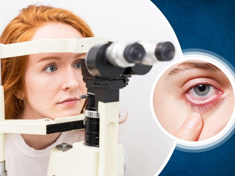 5 Corneal Diseases That Can Cause Serious Damage To Your Eyes