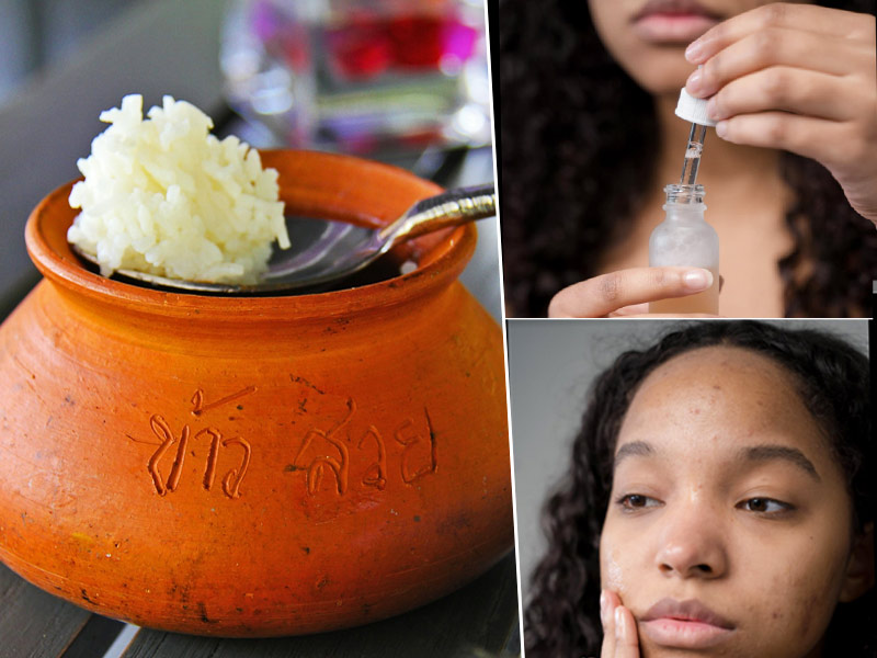 Rice Water Benefits For Skin & Hair: Know Its Benefits And Ways To Use