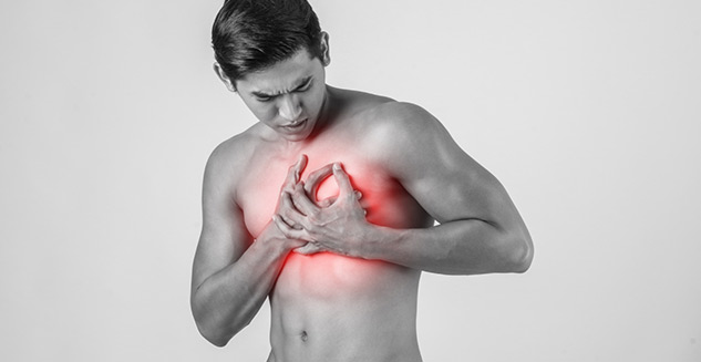 Cardiac Attack