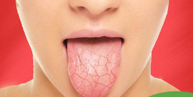 Inside2crackedtongue