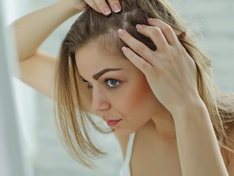 5 Lifestyle Habits That Cause Hair thinning