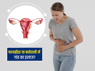 बच्चेदानी में गांठ (फायब्रॉइड्स) का इलाज समय से कराना क्यों है जरूरी? जानें इलाज में देरी के खतरे