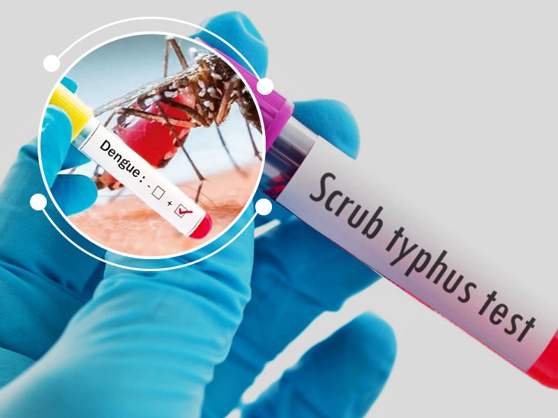 Dengue VS Scrub Typhus: Know Symptoms, Causes, Treatment & Prevention Tips
