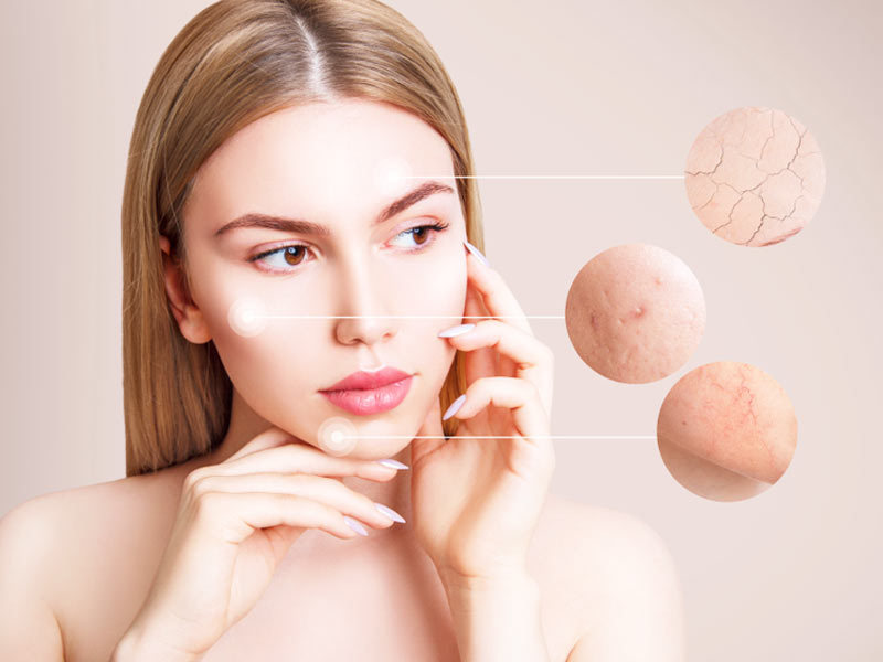 5 Kinds Of Skin Blemishes And Treatment For Flawless Skin