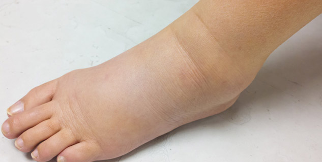 water retention in hindi