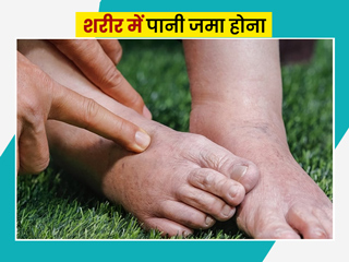 शरीर में पानी जमा होने (वाटर रिटेंशन) क्या है लक्षण, जानें ये समस्या दूर करने के आसान उपाय