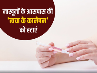 नाखूनों के आसपास की स्किन के कालेपन को दूर करेंगे ये 6 आसान घरेलू उपाय