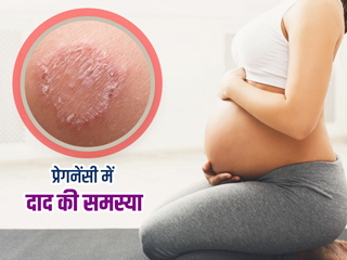 प्रेगनेंसी में दाद की समस्या होने पर क्या करें? जानें इसके कारण, लक्षण और इलाज के उपाय