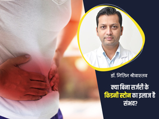 क्या बिना सर्जरी के भी हो सकता है किडनी स्टोन का इलाज? जानें क्या कहते हैं डॉक्टर