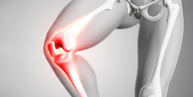 Osteoporosis