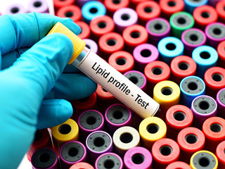 लिपिड प्रोफाइल टेस्ट (Lipid Profile Test) क्या है? डॉक्टर से जानें किन समस्याओं में किया जाता है ये टेस्ट