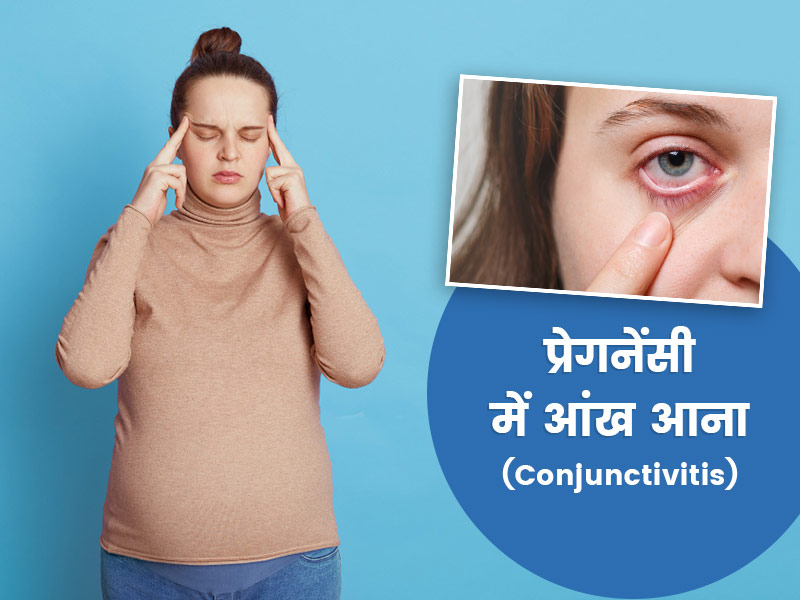प्रेगनेंसी में आंख आने (Conjunctivitis) के होते हैं ये 7 कारण, जानें लक्षण और बचाव