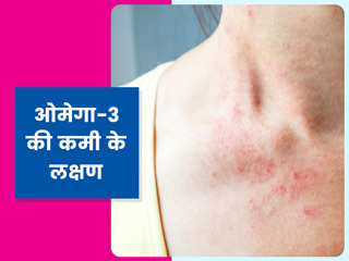 ओमेगा-3 की कमी से शरीर में दिखते हैं ये 10 लक्षण, एक्सपर्ट से जानें कारण, उपचार और डाइट टिप्स