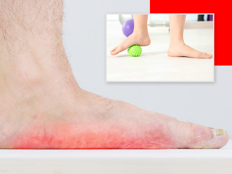 How to Use Ice & Heat for Plantar Fasciitis Symptoms - Vive Health