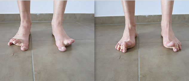 5 Simple And Effective Exercises That Can Help You To Relieve The Pain  Caused By Flat Foot