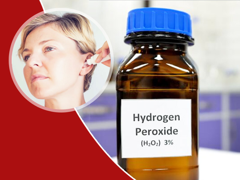 कान की मैल (ईयर वैक्स) निकालने के लिए हाइड्रोजन पेरोक्साइड का प्रयोग करना कितना सुरक्षित है?