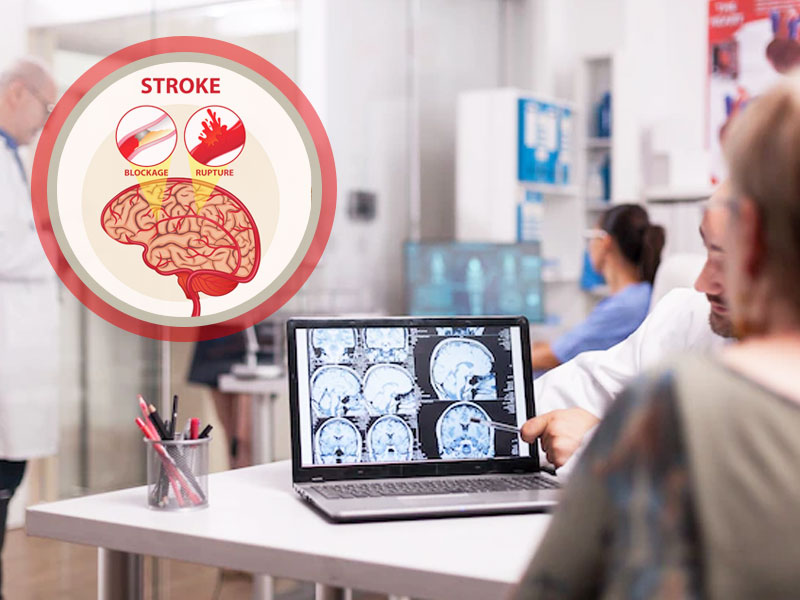 Golden period”: Importance of time in the management of stroke - Sahyadri  Hospital