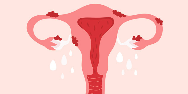 uterus