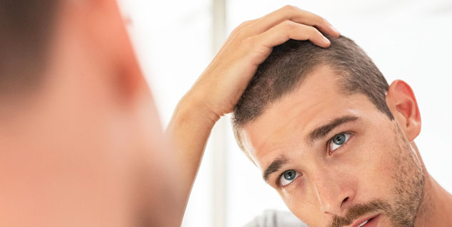 baldness in men