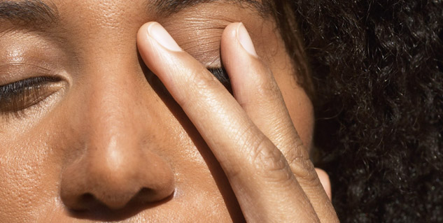 facial dandruff problem