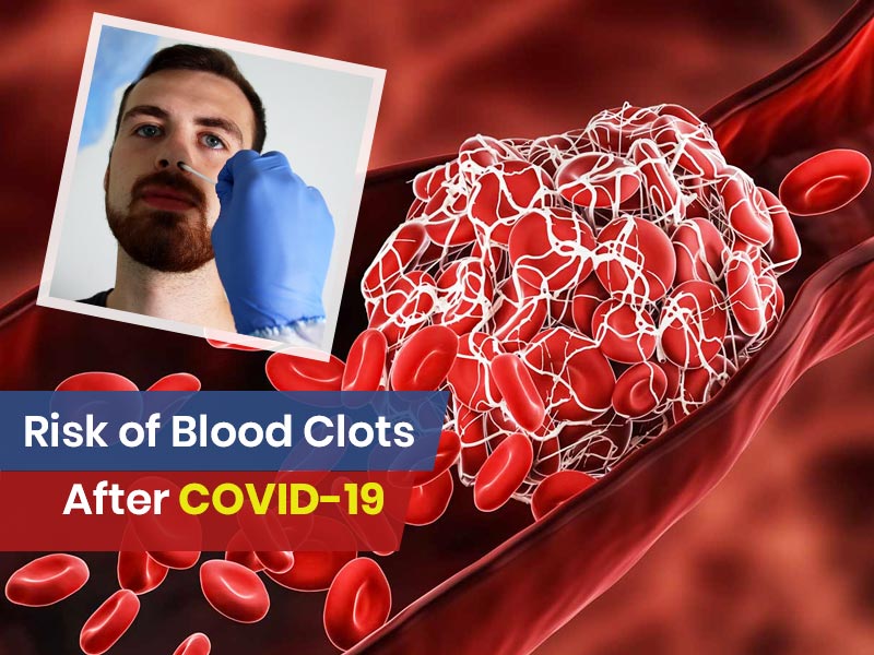 Risk Of Blood Clots Can Increase After COVID-19 Infection: Study