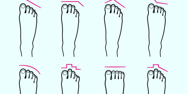 pain in leg