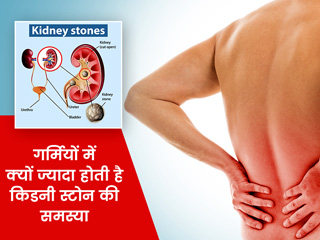 गर्मियों में क्यों ज्यादा होती है किडनी की पथरी की समस्या? डॉक्टर से जानें कारण और बचाव के उपाय