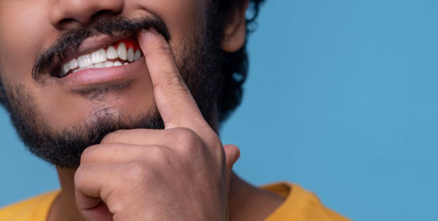 Home-Remedies-For-Black-Gums