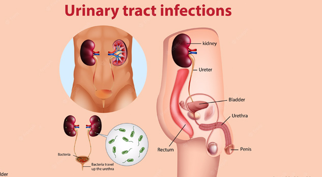 Urinary Tract Infection, Antibiotic Use