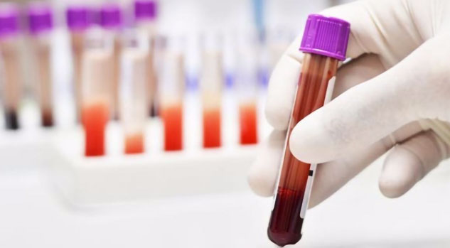 blood_test