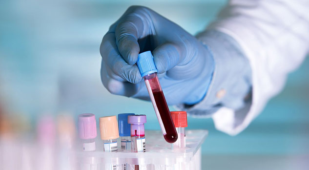 Liquid-Biopsy-Test-For-Cancer