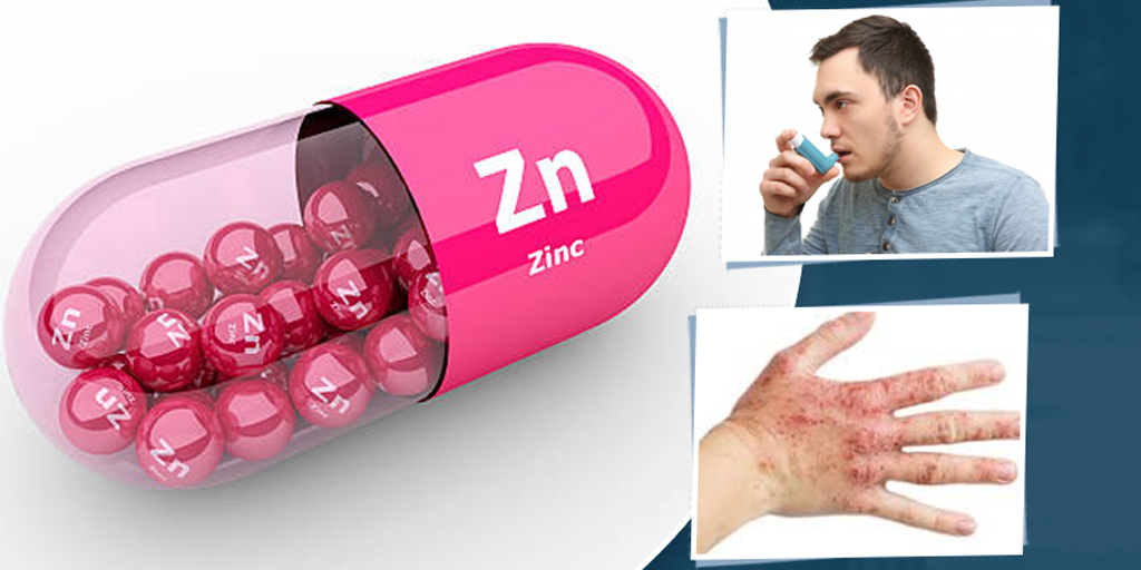 Zinc Supplements How Can Zinc Reduce Allergies Onlymyhealth