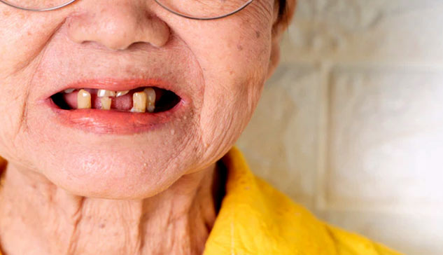 Dental health after 60
