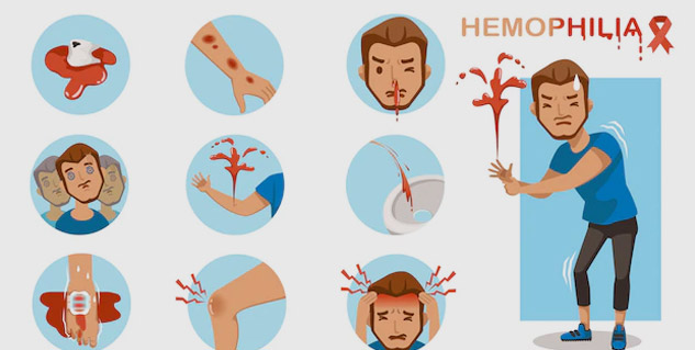 Hemophilia