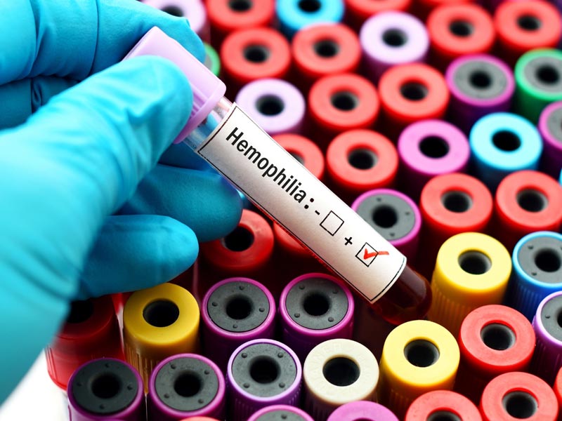 World Hemophilia Day 2022: What Is The Difference Between Hemophilia A and B